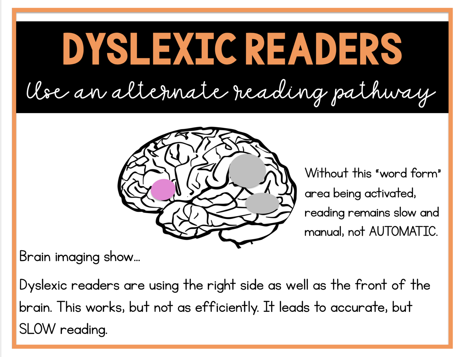 all-about-dyslexia-sarah-s-teaching-snippets