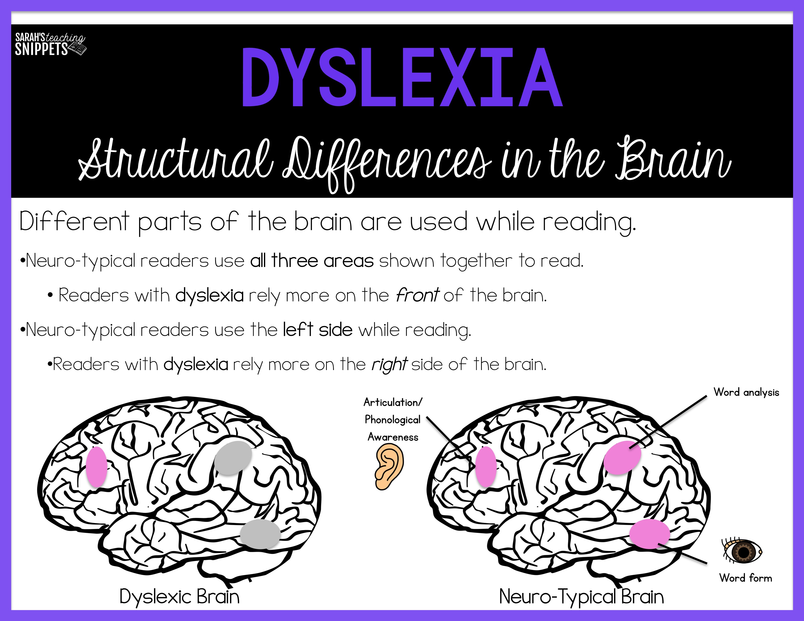 Can Dyslexia Cause Speech Problems